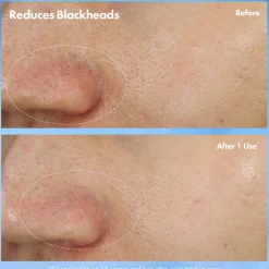 Origins Clear Improvement Blackhead Clearing Mask-To-Scrub, 75 ml* Ansigtspleje