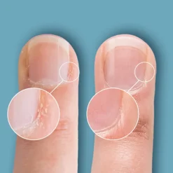 CND Cuticle Eraser* Negle