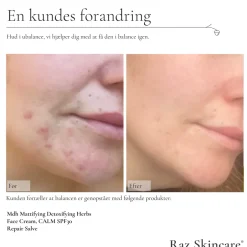 Raz Skincare Repair Parfumefri Salve, 15 ml* Kropspleje