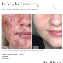 Raz Skincare Repair Parfumefri Salve, 15 ml* Kropspleje