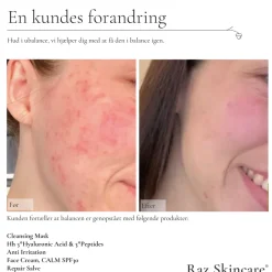 Online Raz Skincare Repair Salve, 15 ml