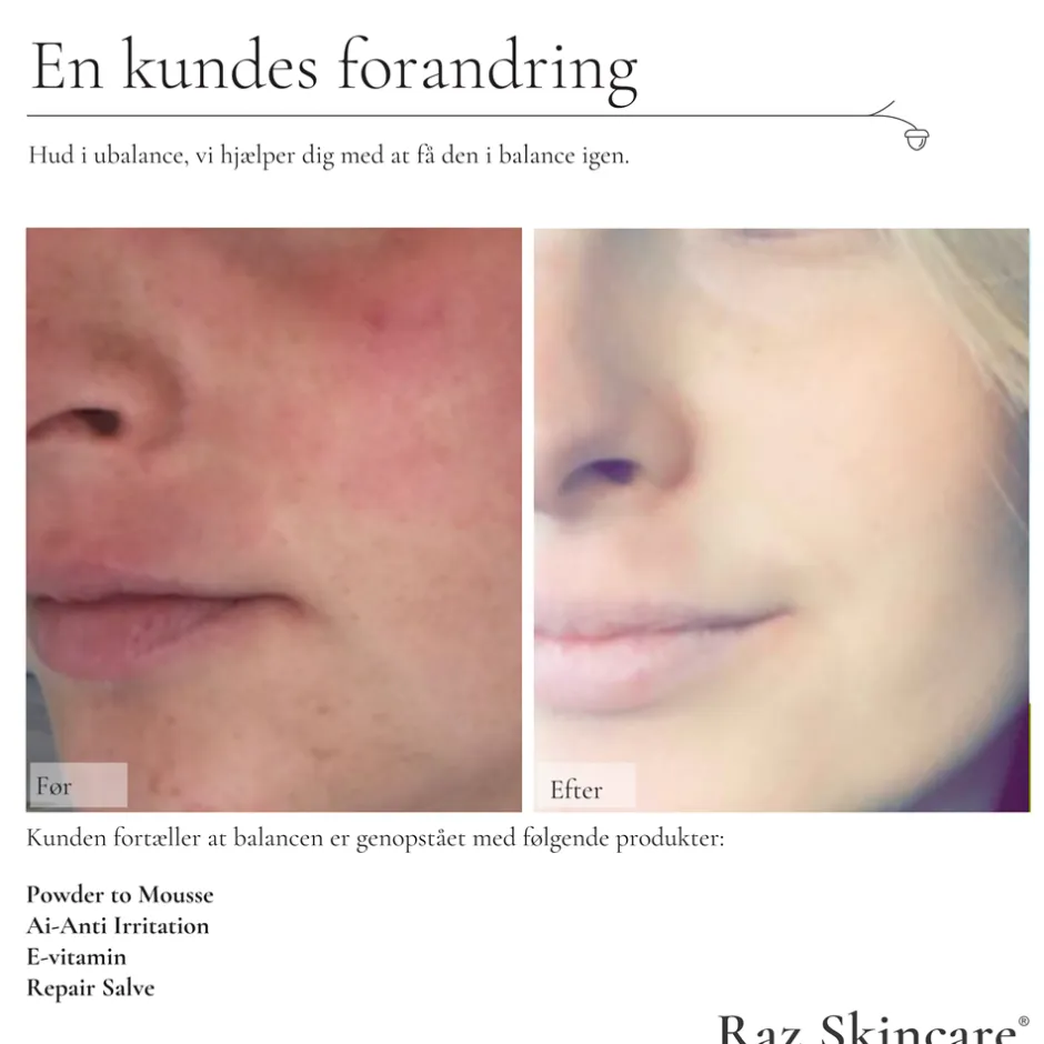 Online Raz Skincare Repair Salve, 15 ml