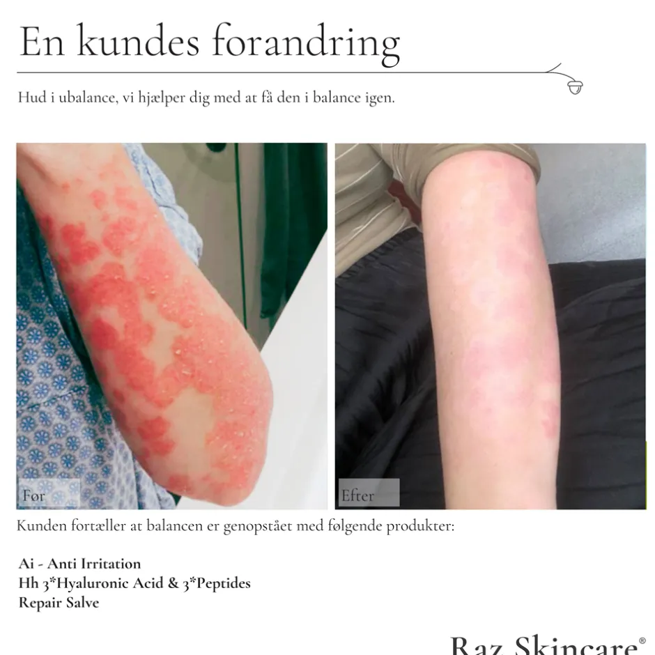 Raz Skincare Repair Salve, 100 ml* Hudpleje