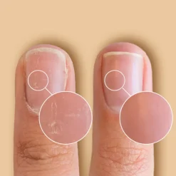 CND Solaroil Nail Care* Negle